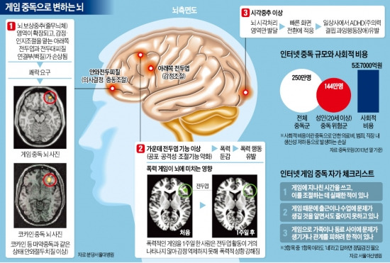 게임중독에 쪼그라든 뇌…'툭'하면 '욱'하게 만든다